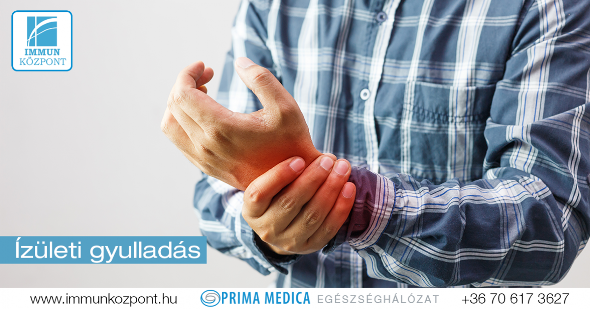 Rheumatoid Arthritis | Deldunantulifurdok