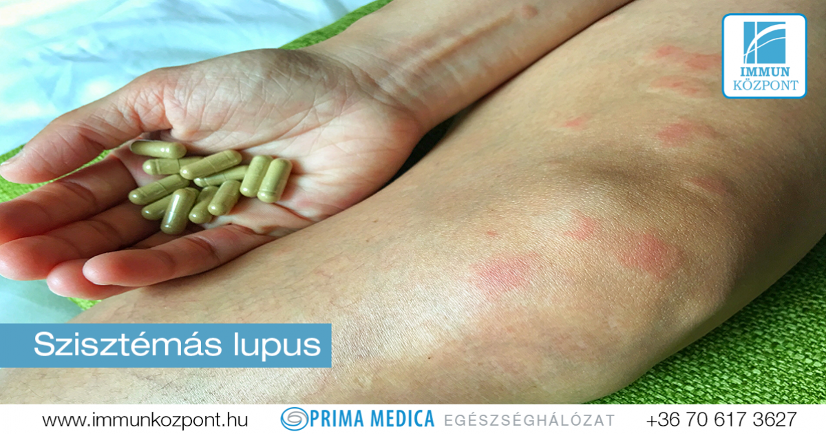 lupus erythematosus ízületi fájdalom)