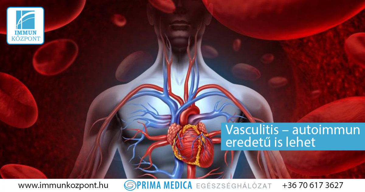 vasculitis ízületek kezelése gyógyszerek a fogyás hatékony listája