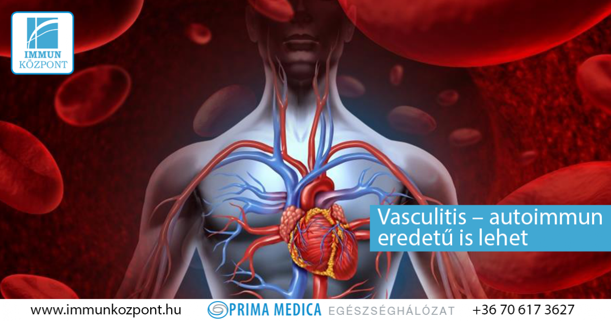 vasculitis és látás