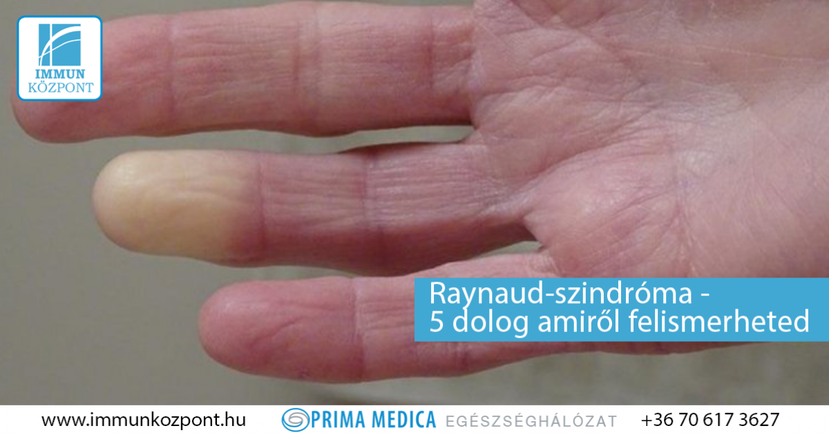 raynaud ízületi fájdalom szindróma)
