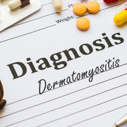 Dermatomyositis