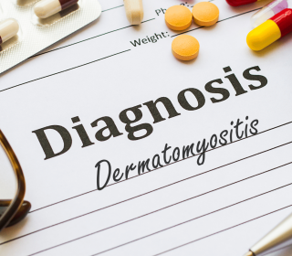 Dermatomyositis