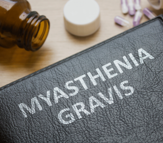 Myasthenia gravis 