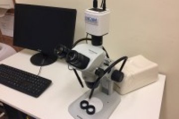 Hogyan zajlik a kapillármikroszkópos vizsgálat?