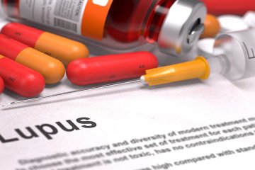 A lupus tünetei – 5 gyakori panasz