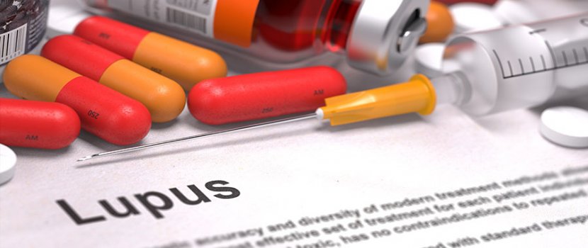 A lupus tünetei – 5 gyakori panasz