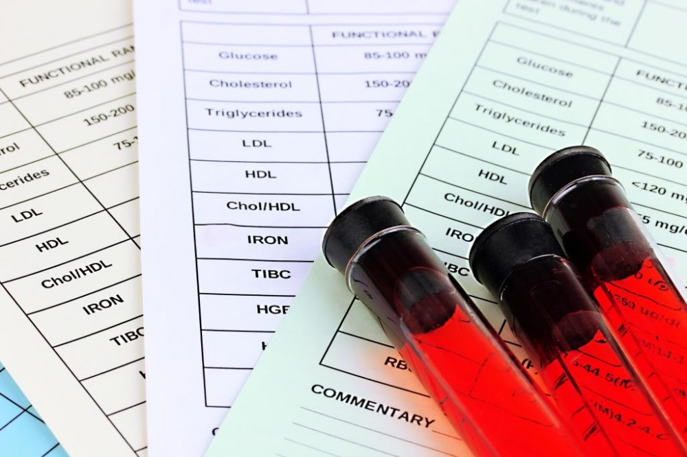 fogyás polymyalgia rheumatica