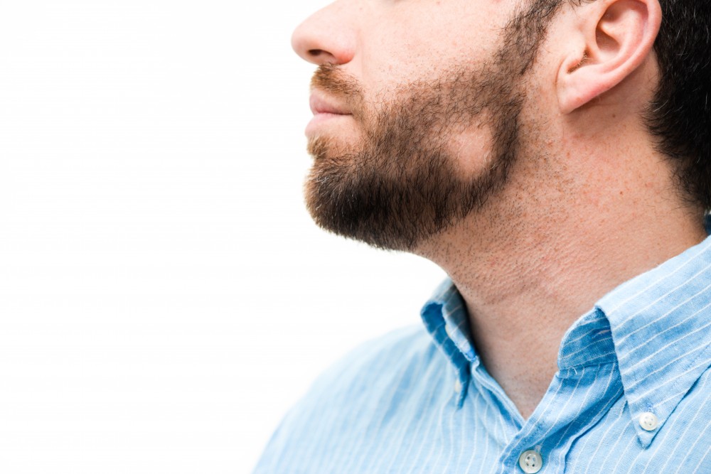 foltokban hiányzó szakáll